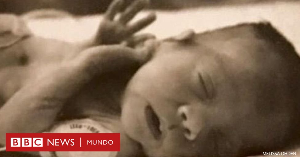 bbcmundo's tweet photo. "Mi madre pensó que me había abortado pero sobreviví" https://t.co/RfrX2srY1M https://t.co/a5GId8ckdV