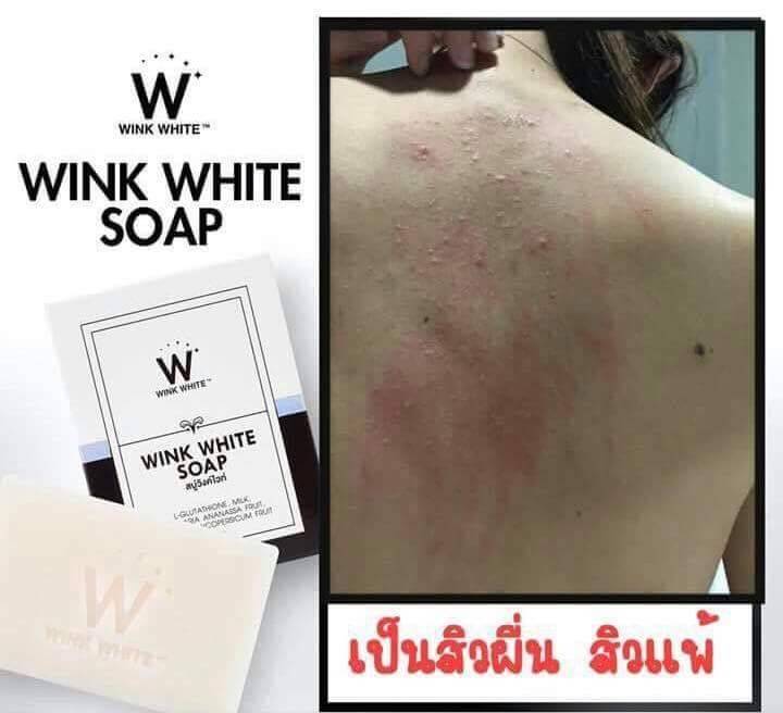 WinkPath's tweet image. #WINKWHITESOAP  ถ้าจะดีขนาดนี้ ‼️
ผลลัพธ์ชัดเจนขนาดนี้ ตำสิคะ รออะไร ❓❓

60 บาท 80 กรัม สนใจทักแชทเลยคร้า 😊