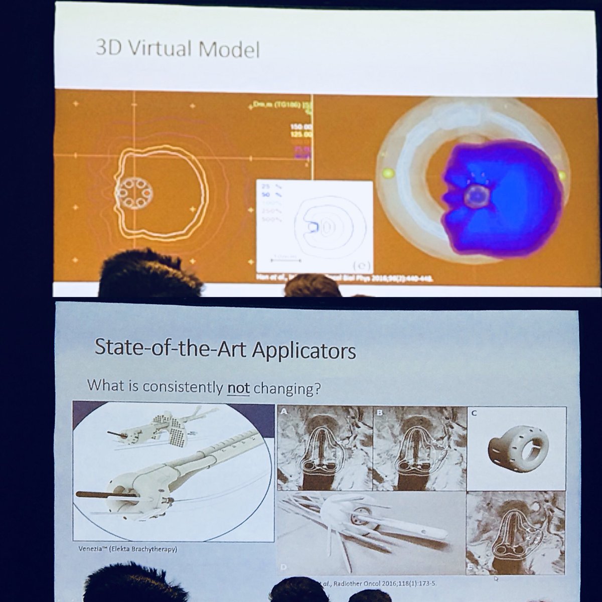 DBuscariolloMD's tweet photo. Motivating presentation by Dr. William Song @VCU on his promising applicator prototype and intensity modulated HDR brachy using robotics & inverse planning. About time for more #gynbrachy R&D - potential translation into benefits for prostate HDR as well! #ABSBRACHY18 #gyncsm https://t.co/w2A6PIa0ce