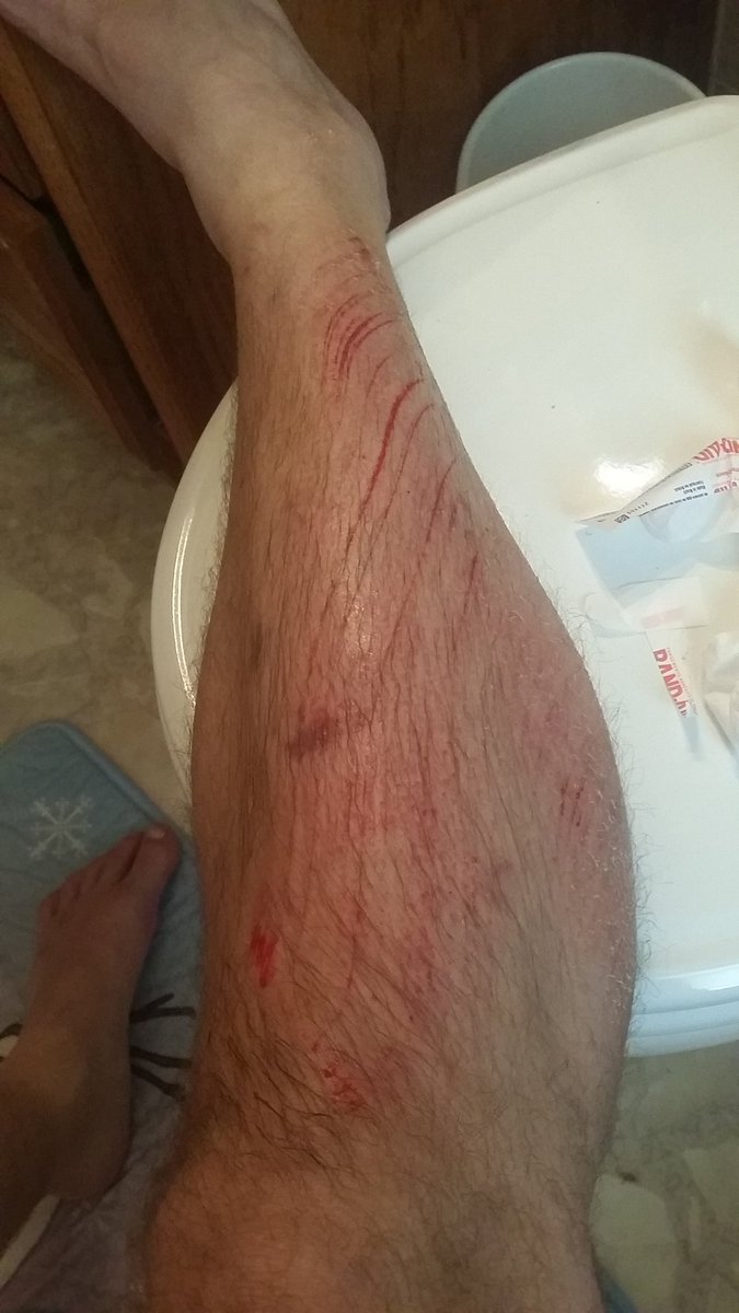 Otei3D's tweet photo. I ran today and lost my balance.
My right shin and calf have what looks like claw marks. Still going to #run at 5:30am. 👻明日、午前5時半に #走る https://t.co/hRahJSWx0Z