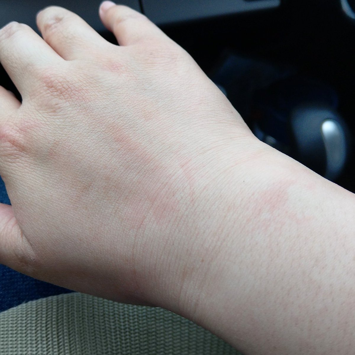 メガロポリス 横に いらいらさせる 柔軟 剤 かゆい Estivaletart Com