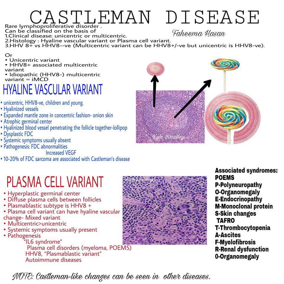 Castleman disease .
#pathology #hemepath #pathclues.