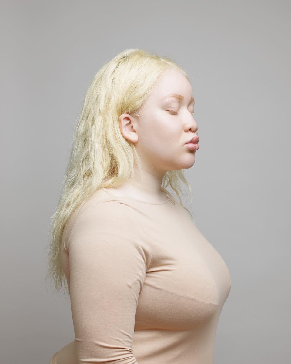 Albino - Real albino ass â€” Elstrad.eu