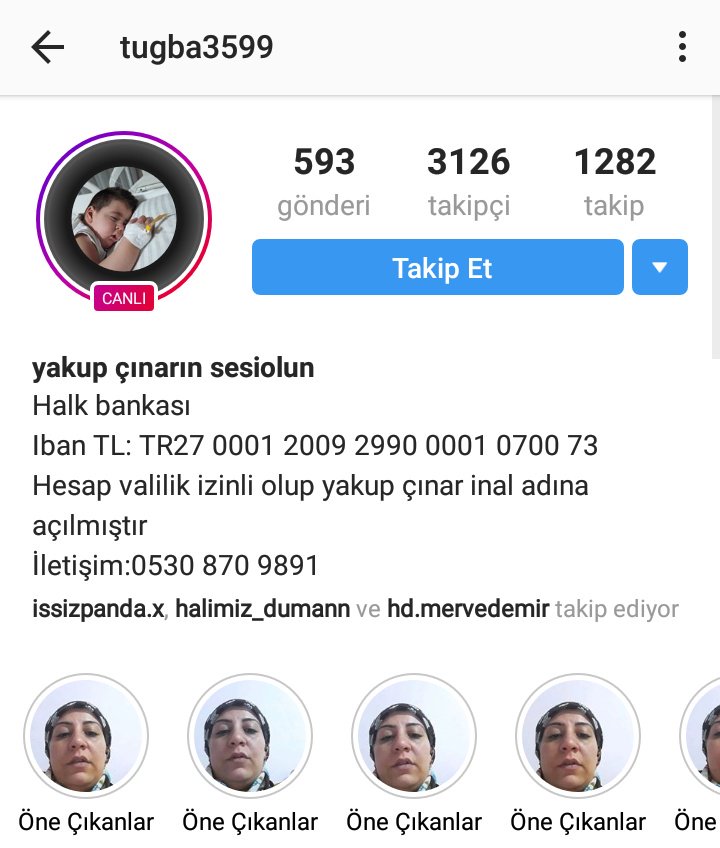 DIYPlatformu's tweet photo. #acil #paylaşalım

Adı Yakup Çınar, skolyoz hastalığı bulunmakta. Bunun yanında solunum sıkıntısı var. Kuyruk sokumu yok. Ciğerlerinde sorun var. Mide kapagı yok. Acil ameliyat olması gerek. Yardımlarınızı bekliyor.

@Sari_Melekler 
@MehmetSercanOge 
@yardimeli 
@Metin_Senturk https://t.co/I8L4QqFgsx