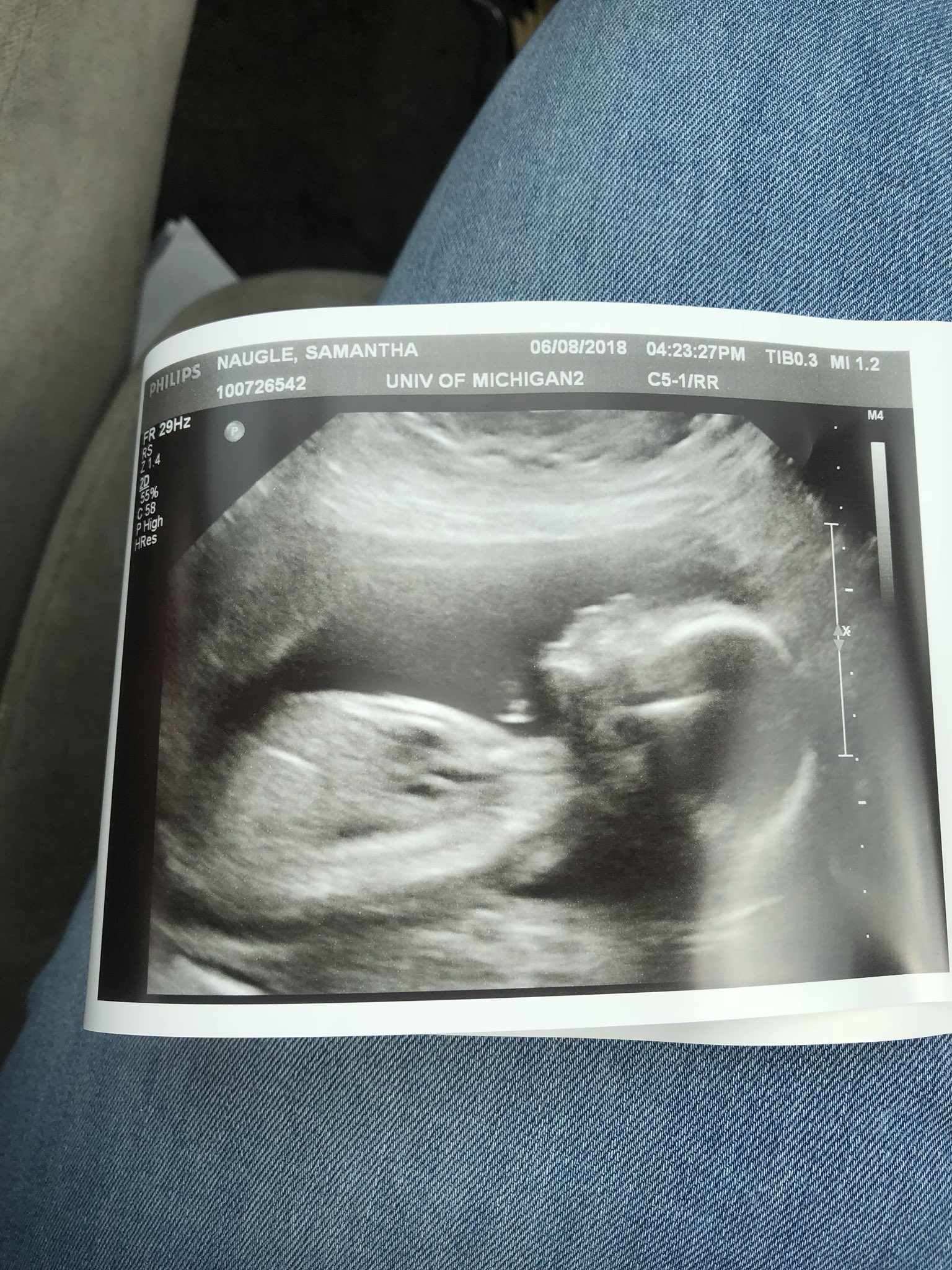 Boy or girl, baby I need you to know Mom and Dad are already too excited to meet you. 🤰🏻😍💜💙 https://t.co/nfrypzukx9