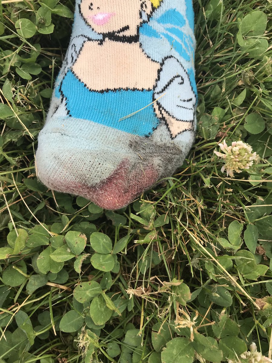 chrisbschmitz's tweet image. Good start to the summer training season with a 2nd place finish and almost four minutes faster than last year at the @RunToTheEndROC race.  Channeling Pre with the bloody foot for the race @CCCSDxc @CCCSDtandf #dothework