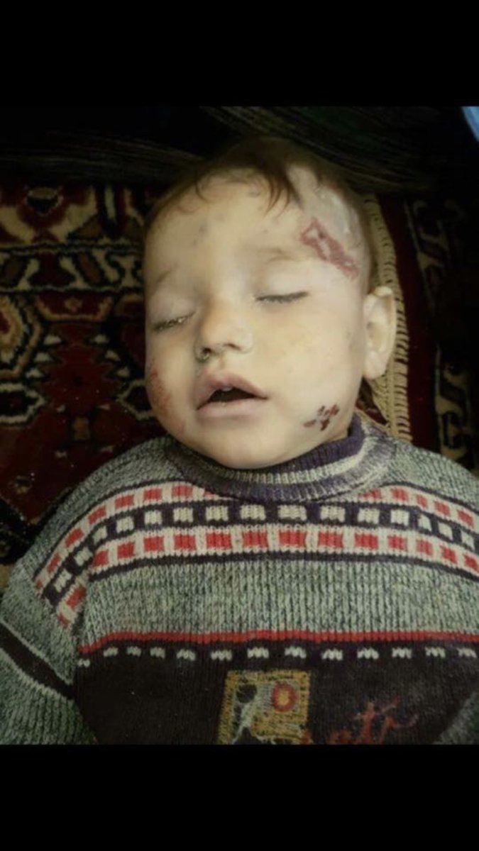 As_Alsharaa's tweet photo. #Putin_Assad genocide
And the world's hypocrisy, duplicity &amp; complicity. SpeakUP against AssadCrimes PutinCrimes https://t.co/mrxKWyXn3V