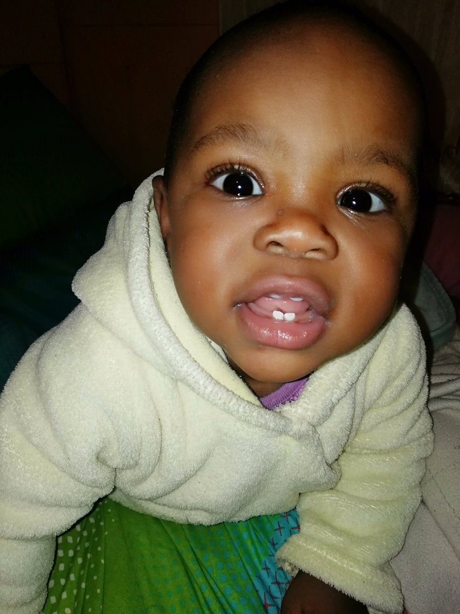 Mbongen80715278's tweet photo. Yees finally I've got the upper teeth #Thingo
#MyDaugther https://t.co/5Gy3YwquNz