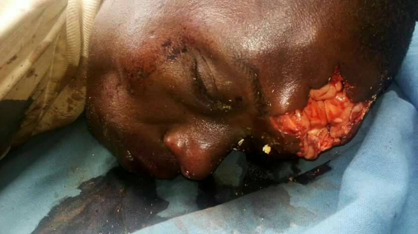 NkengbezaD's tweet photo. @billyb2009 UK an accomplice in the killing. 
Shame on UK https://t.co/OxiR7T9nIe