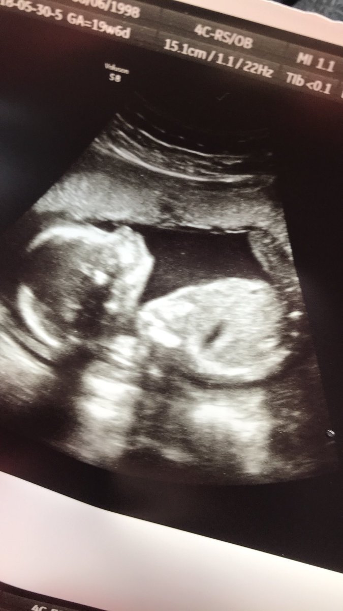 sonogram hashtag on twitter
