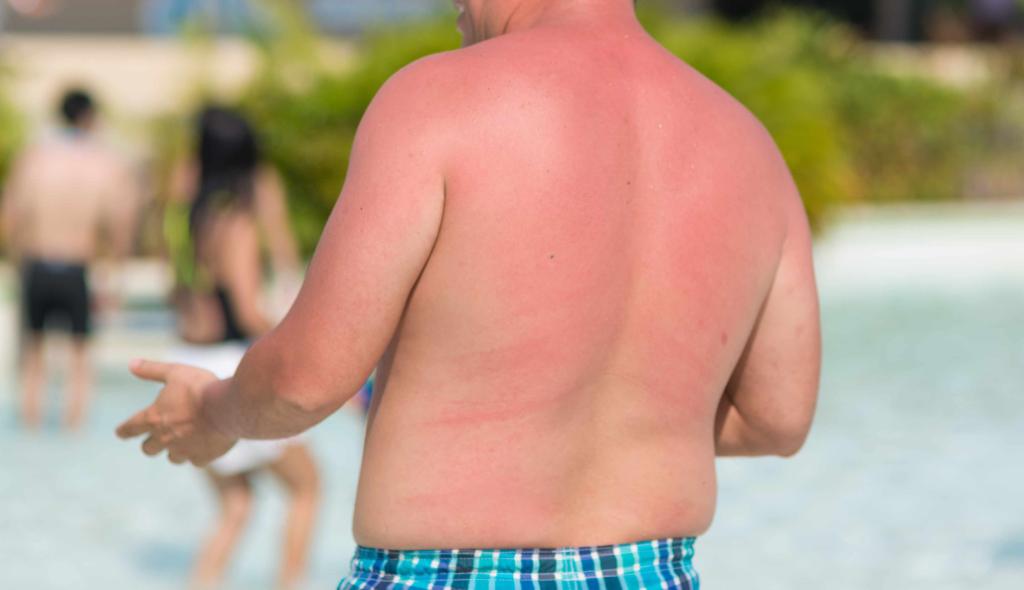 MayoClinic's tweet photo. By age 65, Caucasian men are reportedly twice as likely as women to get #melanoma. "Melanoma is often believed to be 'just another #SkinCancer,'” says oncologist Dr. Svetomir Markovic. "Unfortunately, this is not true." https://t.co/8zLiHSCMcS https://t.co/40SUczGfev