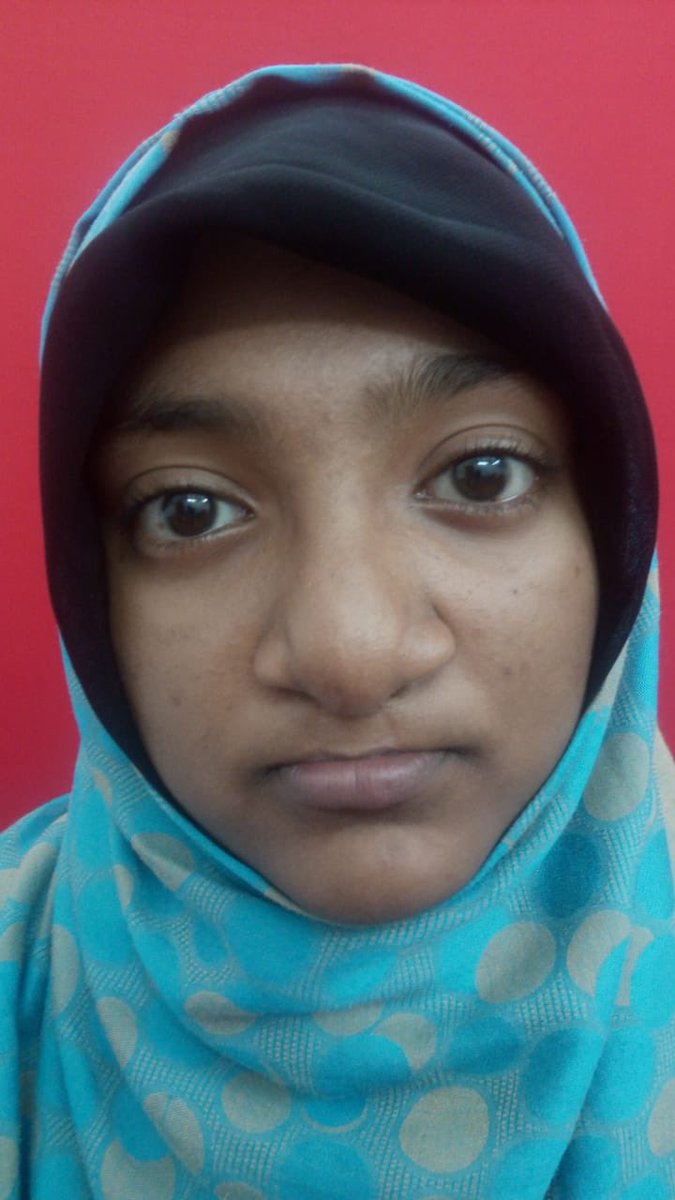 AndeiSoI's tweet photo. Happy to see this Patient for review:
We had done her lip Revision or redo lip surgery 6 months ago. Earlier, she had had a few surgeries elsewhere but was not completely rehabilitated.
#RedoSurgery #plasticsurgery #cleftlip #bilateral #unilateral https://t.co/oKU8GEVDpm
