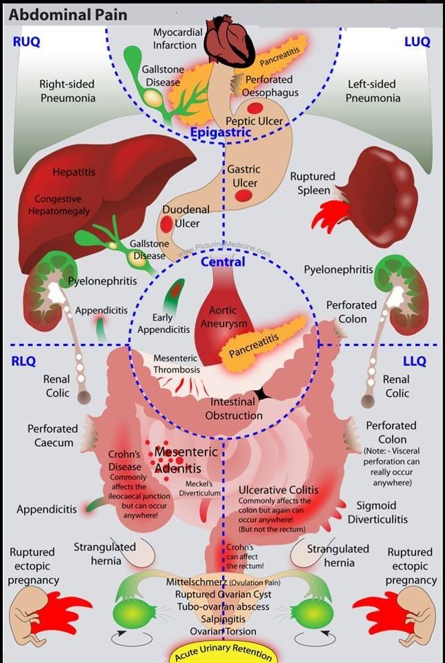 MirNemotecnias's tweet photo. Causas de Dolor abdominal. #mir19 #MIR https://t.co/4NabpbvRta