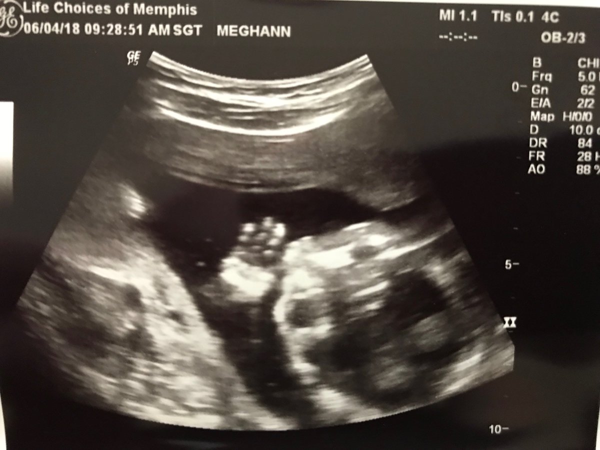 Marlow Summers Kirk coming in hot this October. Halloween birthday parties forever!