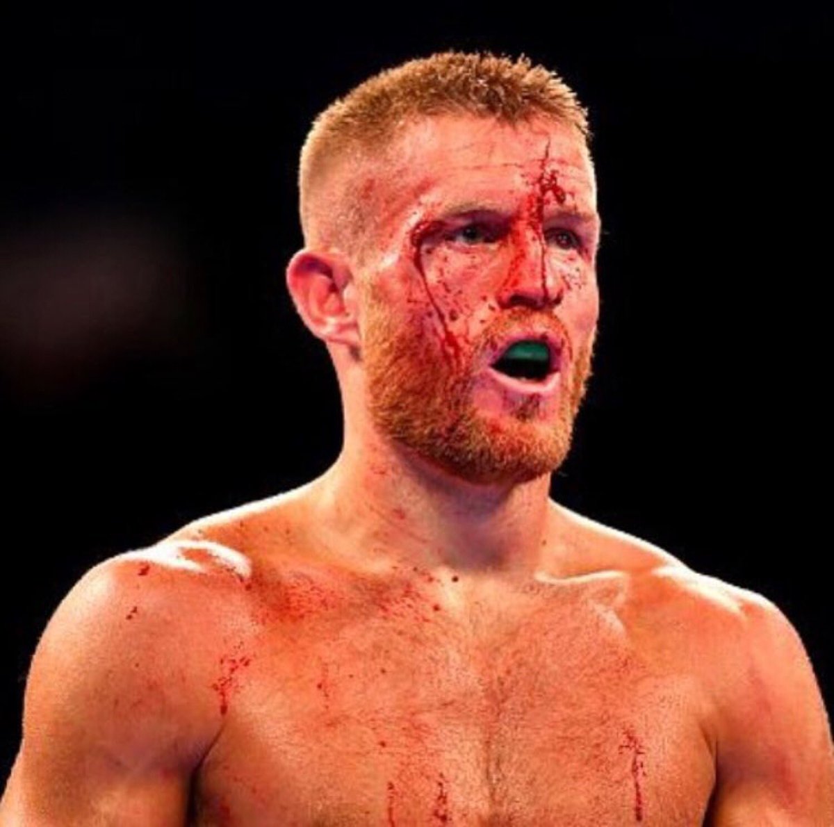 terryflanagan5's tweet photo. just like to thank all my fans and everyone who came to the fight and watched at home , last night wasn’t my night no excuse I’ll be back and I’m sure this will make me a better fighter. https://t.co/QZJblbQxA1