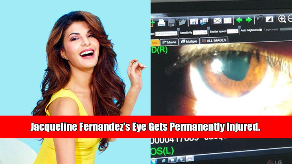 spicytrivia's tweet photo. Jacqueline Fernandez’s Eye Gets Permanently Injured. https://t.co/4Od9OAwgWT https://t.co/sgwLKFwhsI