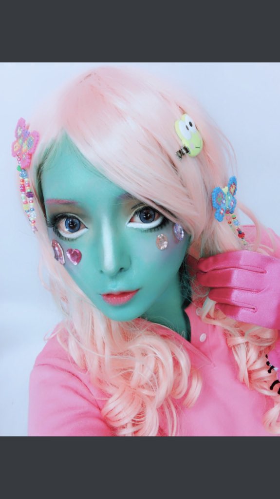 肺腺癌ステージ4