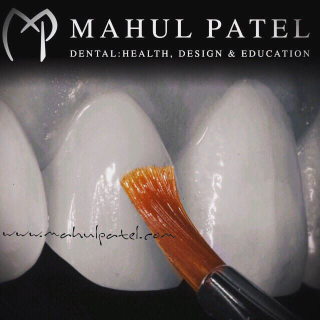 DrMahulPatel's tweet photo. Hands-on Course Anterior Resin Restorations:
Planning and treatment of delivering aesthetic and functional restorations for single and multiple units.
#drmahulpatelrestorative #since2002 #toothbeforeself #handmade #handcrafted #madebyhand #compositeresin #mizrahidentalteaching https://t.co/1mlFI6zBOO