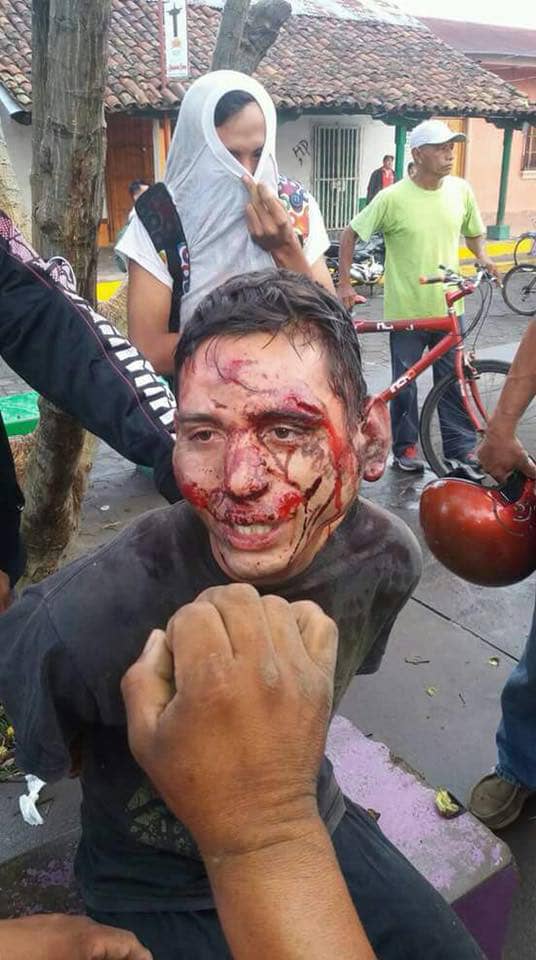 MelysGarcia's tweet photo. Tan cómplice como asesina es la @OEA_oficial cuando ve como la derecha terrorista de #Nicaragua masacra al pueblo de Sandino. El mundo debe alzar la voz #NicaraguaQuierePaz .@evoespueblo @NicolasMaduro @Dilma @LulapeloBrasil @MashiRafael @CFKArgentina @RomelGuardian_ https://t.co/By3uxnddPL
