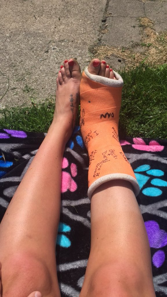 meggles_26's tweet photo. Tomorrow is an exiciting day. This is stupid thing comes off and @Cory5cents comes home but mostly this stupid thing comes off...hopefully! #theadventuresofmeghansfoot #goodbyecast https://t.co/y1YJwNYXhd