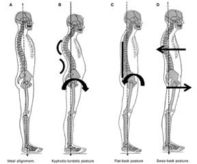 AlderleyPilates's tweet photo. #whatsyourposture
Are you A ?
If so you must be doing pilates! Keep it up! #passionateaboutposture #passionateaboutpilates https://t.co/AgX011kNeD