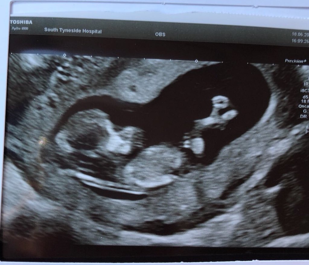 Dorra373's tweet photo. Ashleigh and I are over the moon to announce a new little addition to the family #PrayingForABoy #LittleDennis https://t.co/8gadGShSch