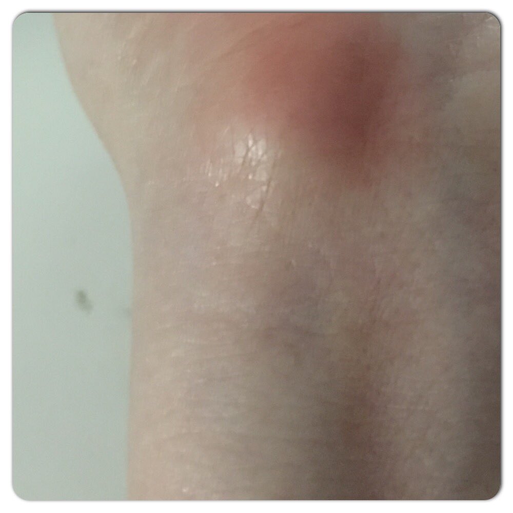 yvonnalynn's tweet photo. Wrist Callous- sexiest thing about a girl to a gamer! Getting back to PC mouse instead of controller reminded me of this hawtness & had to hunt up my wrist pad ^_^ #gamer #sexy #wrist #pcmasterrace #twitch #streamer #cyatomorrow #yvonnasllamas #iloveyou https://t.co/gUOOWRE7uj