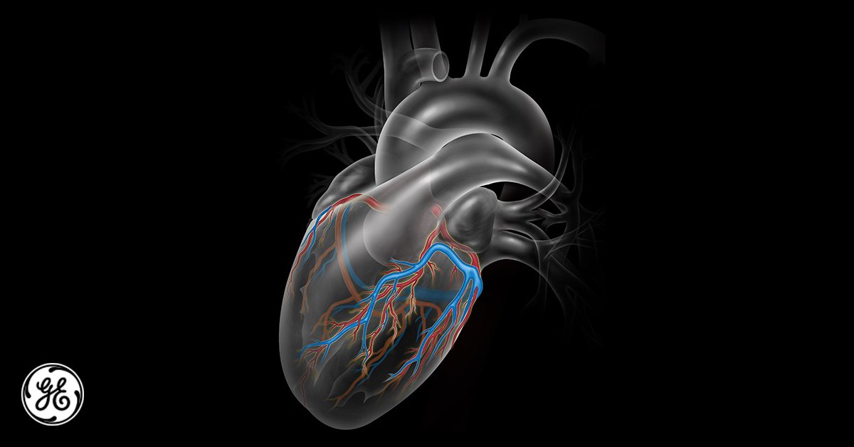 GEHealthCare's tweet photo. #Cardiologists will soon be #data scientists too https://t.co/44tTGJ0HZZ
#cliniciansandcode https://t.co/W3tqFCU5OG