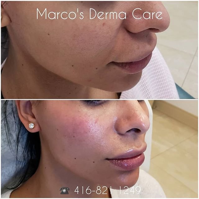 marcos derma care