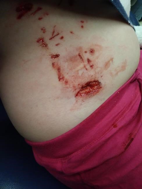 Police dog in Saskatoon bites girl, 6, while tracking home-invasion suspects: bit.ly/2t4Vd59 https://t.co/OwRauIQajx