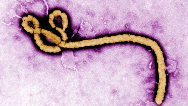 nikostoifberg's tweet photo. This is both the most beautiful and scary picture I've seen this week (okay, the week isn't very old yet). What looks like a teddy bear is in actual fact the ebola virus. #congo #ebola #outbreak2018 https://t.co/3TZ42atyg1