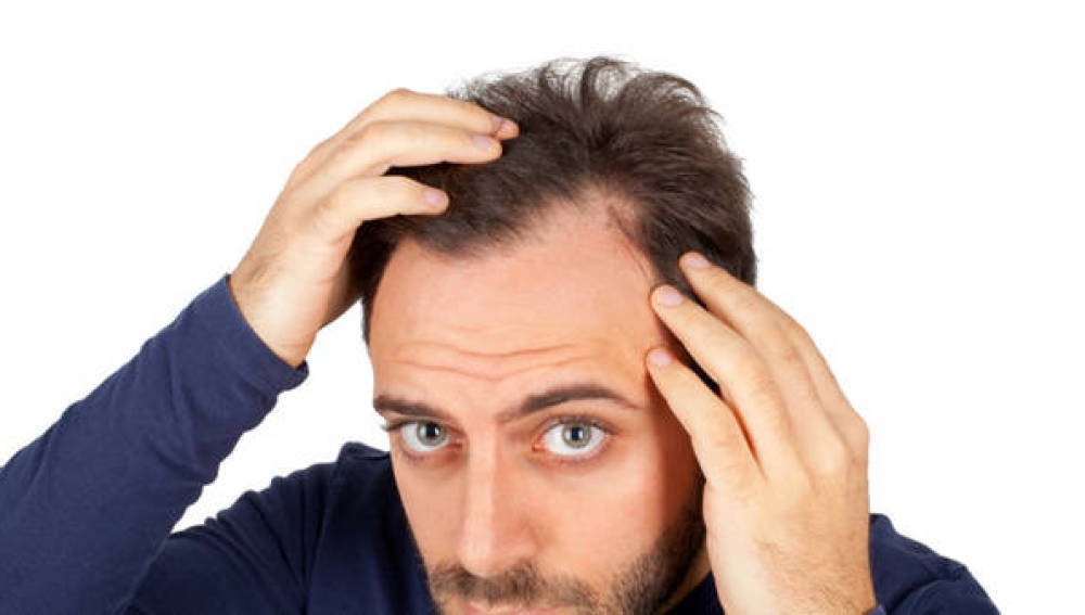 freestyle_es's tweet photo. Investigadores de la Universidad de Manchester han descubierto un tratamiento definitivo para la #alopecia, ¡sin efectos secundarios! + info en nuestro blog! https://t.co/lmrEqKNYnq https://t.co/HXKRkTmRR2