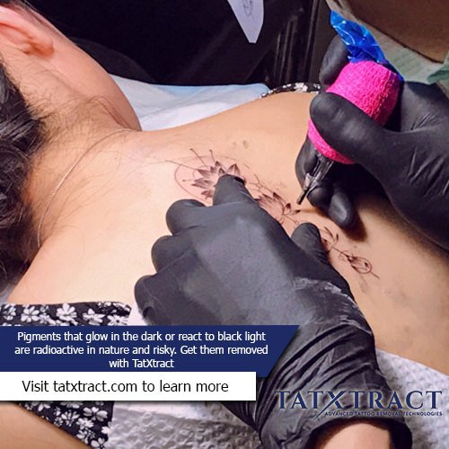 RoseSmi5h's tweet photo. Before you get inked, understand the risks involved in getting a tattoo. The pigments might be risky for your health. Have them removed at TatXtract! #tattoo #inkremoval #evergreen #co https://t.co/QV8I0Ncx1E https://t.co/EZ7032N4Eb