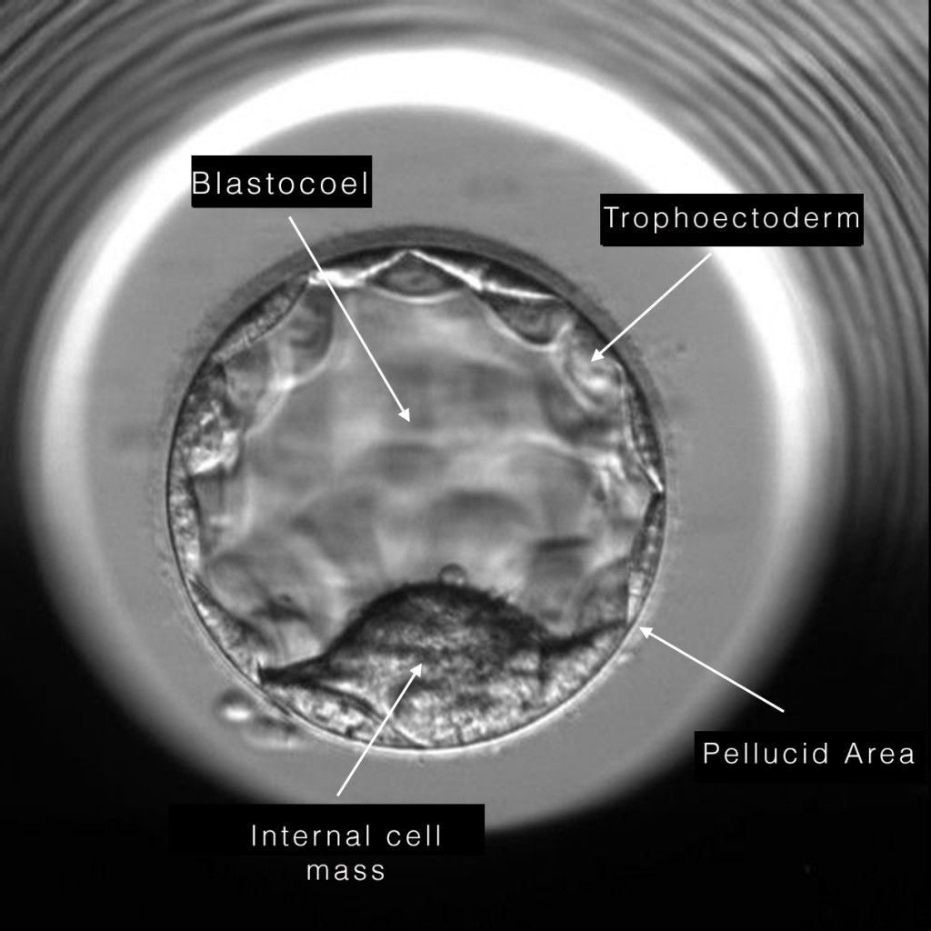 imarques_EN's tweet photo. After an #IVF cycle, embryos can be transferred fresh or they can be frozen and transferred in a later cycle, what we call a delayed frozen embryo transfer. Which option is best? Dr. López-Teijón shares her expertise on this issue on #FertilityExperiences. https://t.co/BVISiTB2d5 https://t.co/hoPK5Pr6jg