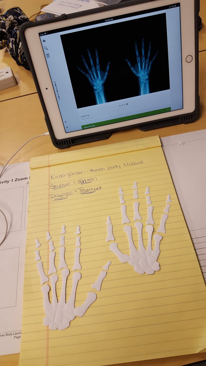 wv_pltw's tweet photo. Day 1 of #PLTW Launch Classroom Training - looking at an X-ray of hands then rebuilding the bones! @JGudenschwager @PLTWorg #PLTWCT https://t.co/JTzx8soRns