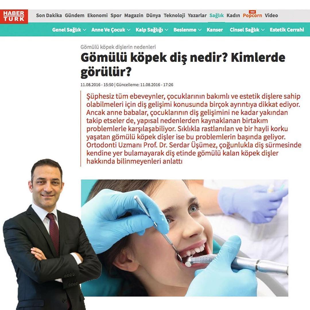 Diğer dişler arasında köpek dişler, sürmesini en geç tamamlayan ve ağızdaki yerini alması 13 yaşını bulan dişlerdir. Genel olarak damakta, seyrek olarak ise dudak tarafına yakın olarak konumlanıyor.
.
.
.
#serdarusumez #saglık #dis #dissaglıgı #health #teethhealth #ortodontik