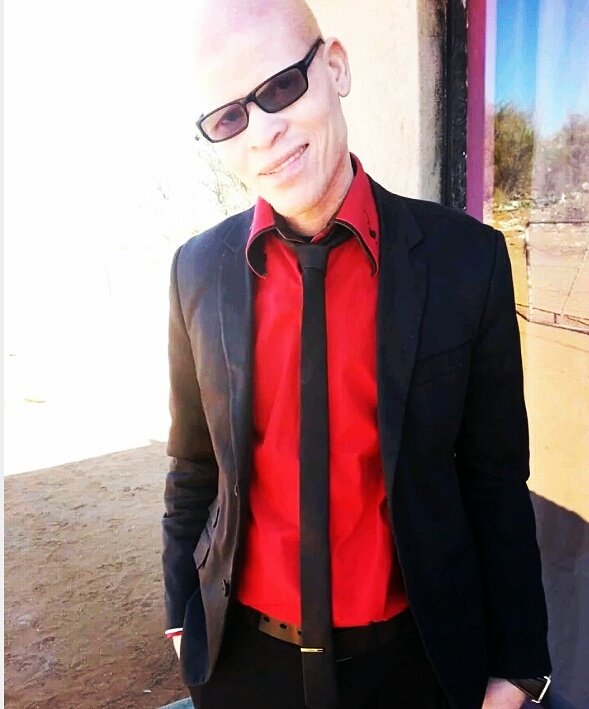tjopem's tweet photo. #WeReallyNeedLess people thinking that our (Albinism) body parts will bring them luck, they must start thinking,inventing &amp; working hard to aquire wealth. We hv eyesight, African Sun, &amp; now we hav to add being hunted as things to watch out for. #justlikeyou @kuliroberts @OSISA https://t.co/DvB9Ui0pEg