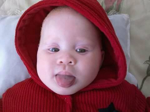 tjopem's tweet photo. #WeReallyNeedLess people thinking that our (Albinism) body parts will bring them luck, they must start thinking,inventing &amp; working hard to aquire wealth. We hv eyesight, African Sun, &amp; now we hav to add being hunted as things to watch out for. #justlikeyou @kuliroberts @OSISA https://t.co/DvB9Ui0pEg