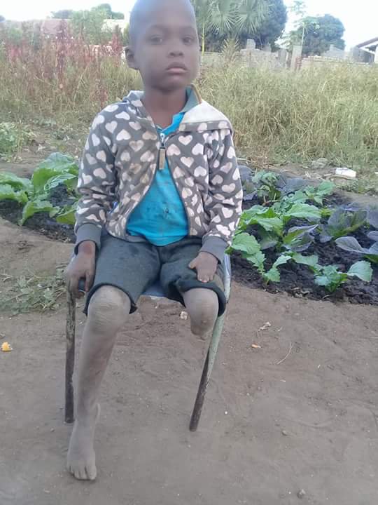 RivalaniMyambo's tweet photo. This is Hlulani Mkhabele from Section F , Giyani. he is looking for a wheelchair. any one one who would like to help him call Pfuxani Chauke 0637127597 / 065 6077 948 . God bless you . https://t.co/guGKwm5vQ9
