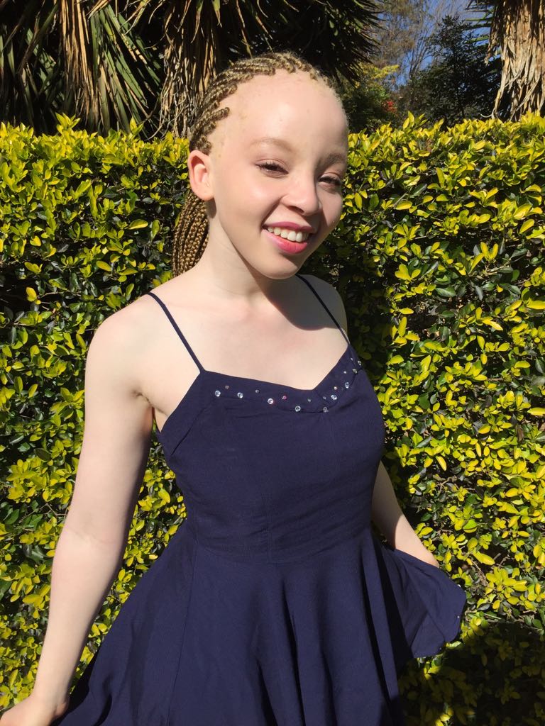 STOP ALBINISM KILLINGS tweet media