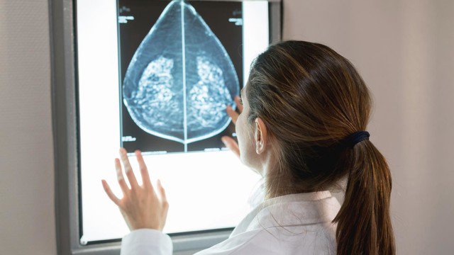 DrZwillinger's tweet photo. "Tous mes symptômes auraient dû alerter les médecins" : quand le cancer du sein est mal diagnostiqué chez les jeunes patientes
https://t.co/pzjkISi5F6 https://t.co/hfRbc8hHCI