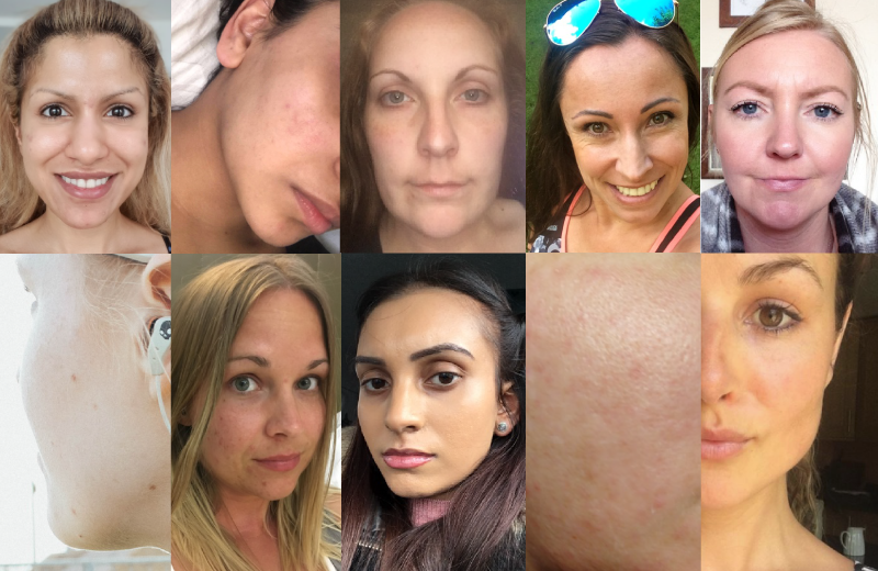 FadeOutSkincare's tweet photo. Let's introduce our #FadeOut4week participants… Some may be familiar to you as beauty bloggers you <3 and some will be new faces - but all have signed up to the 4 week challenge and are hoping for radiant and even complexion in four weeks! #HelloEvenSkin #GlowAndTell https://t.co/b3qGHVfLik