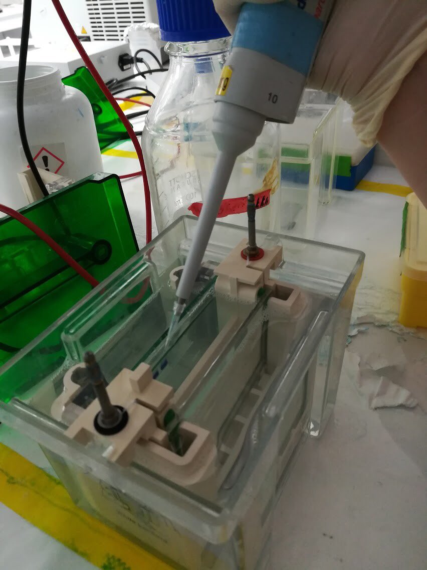 IRES_Singapore's tweet photo. Trying to find where our #protein ended up after separating it from the #bacteria using gel electrophoresis. Thanks Magdelene for the photos! #viruspurification #singapore https://t.co/0pSHPMsZbp