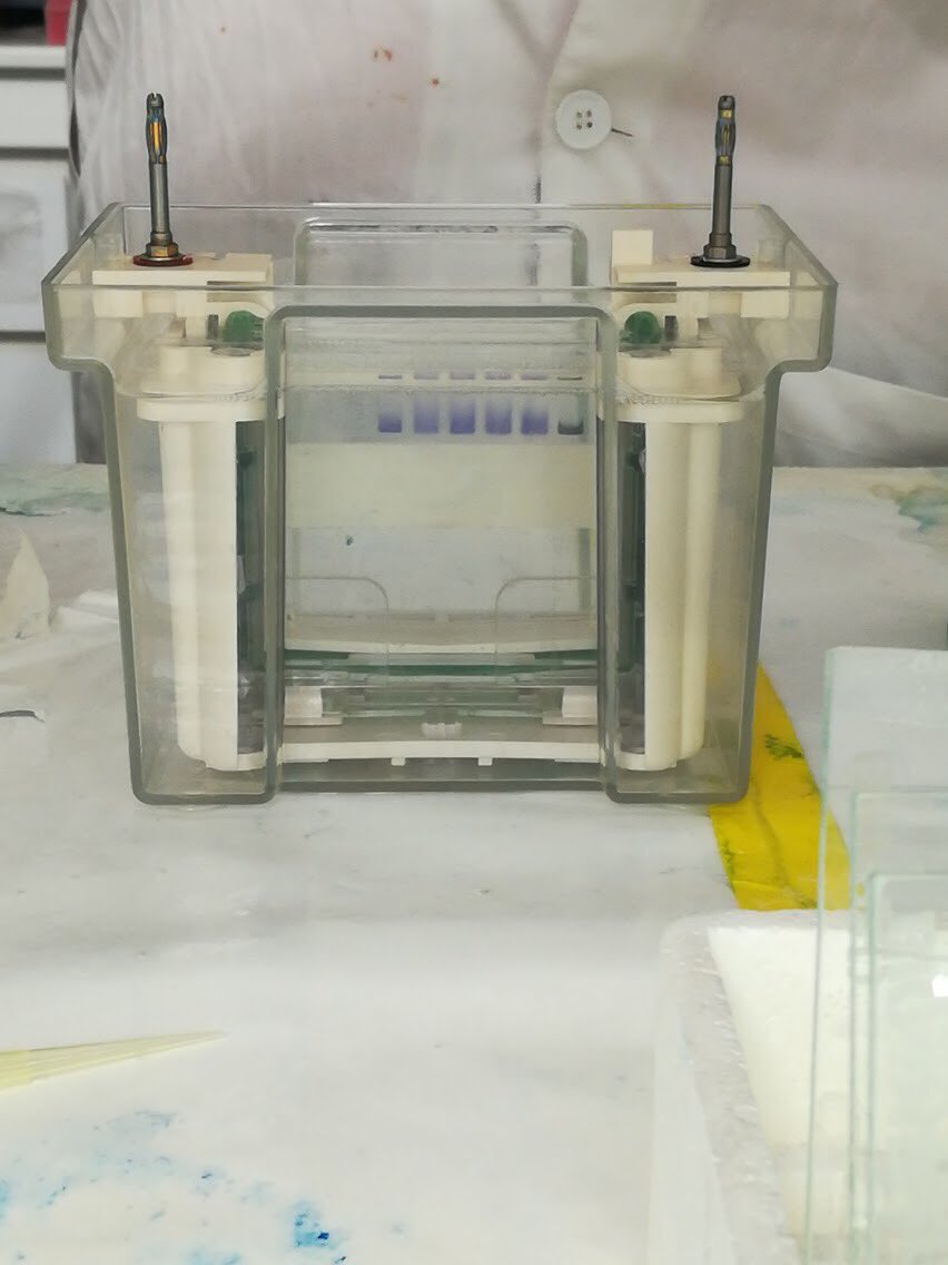 IRES_Singapore's tweet photo. Trying to find where our #protein ended up after separating it from the #bacteria using gel electrophoresis. Thanks Magdelene for the photos! #viruspurification #singapore https://t.co/0pSHPMsZbp