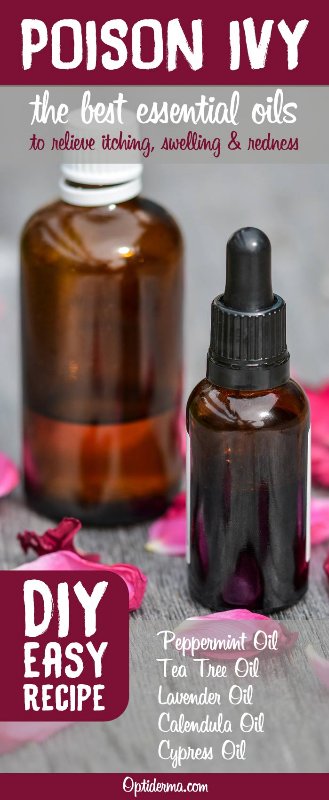 optiderma's tweet image. 5 Best Essential Oils for Poison Ivy sumo.ly/VkoG via @optiderma