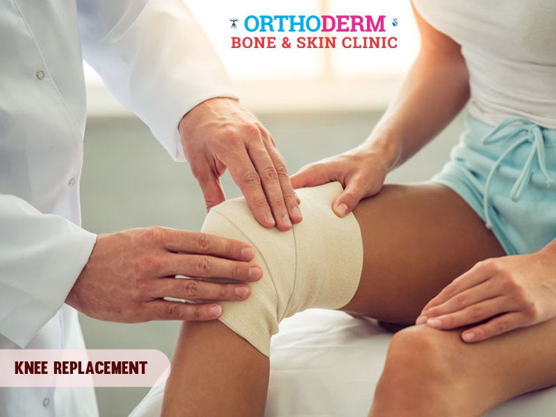 orthoderm_'s tweet photo. Knee replacement surgery provides artificial knees in place of your damaged knees to restore function and relieve pain.

Book an Appointment  +91-9840866029

Visit More@ https://t.co/XAtEwqMvjT

#Kneereplacement #Kneereplacementsurgery #fracture #fracturecare #kneepain https://t.co/h7zYijsxm7