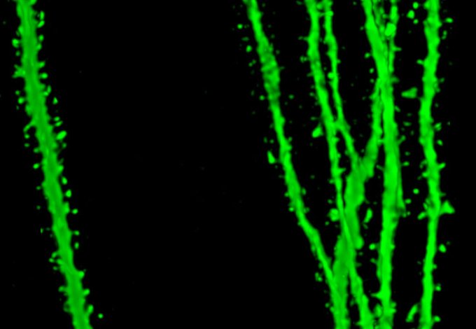 MpiBrain's tweet photo. Cool press release @goetheuni about a recent paper @PNAS co-authored by Marcel Beining, currently postdoc @mh_lab @MpiBrain https://t.co/KNPzkYXXJM #granulecells #neurogenesis #hippocampus #memory #imprs https://t.co/gpJkmyF7JH
