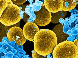 Exelume's tweet photo. Making Headlines: Study shows MRSA superbug infections less costly, but still deadly. https://t.co/erJBuA707W #superbugs #resistance #antibiotics https://t.co/sQWDPNVyYB