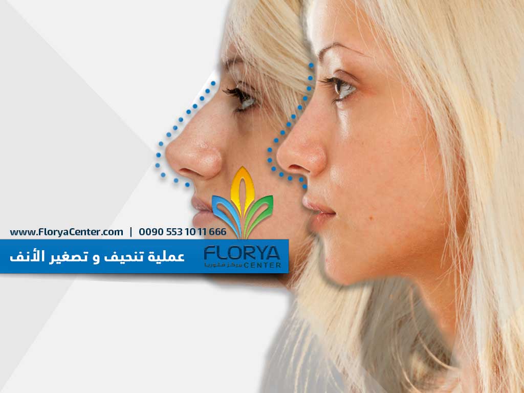 FloryaHospital's tweet photo. #عمليات_التجميل #تركيا
تجميل الأنف
لاتنسى زيارة موقعنا و التعرف على اهم تقنيات عمليات التجميل في العالم
مستشفى ومركز فلوريا التخصصي في عمليات التجميل في تركيا
#عيد_فطر_سعيد
 
للحجز :
☎️ 00905531011666
https://t.co/s6LmPF55uY https://t.co/64iJUCejJX