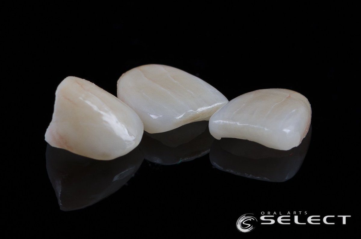 OralArtsDental's tweet photo. Amazing color and detail with these IPS e.max veneers. This patient will for sure be amazed by these results.
#OralArtsHuntsville #OralArtsDental #OralArtsHville #OralArtsDentalLab #OralArtsHSV #DentalLab #DentalLife #Dentistry #OralArtsSELECT #SmileMakeOver #IPSEMAX #EMAX https://t.co/1lZ4S9I1Xe